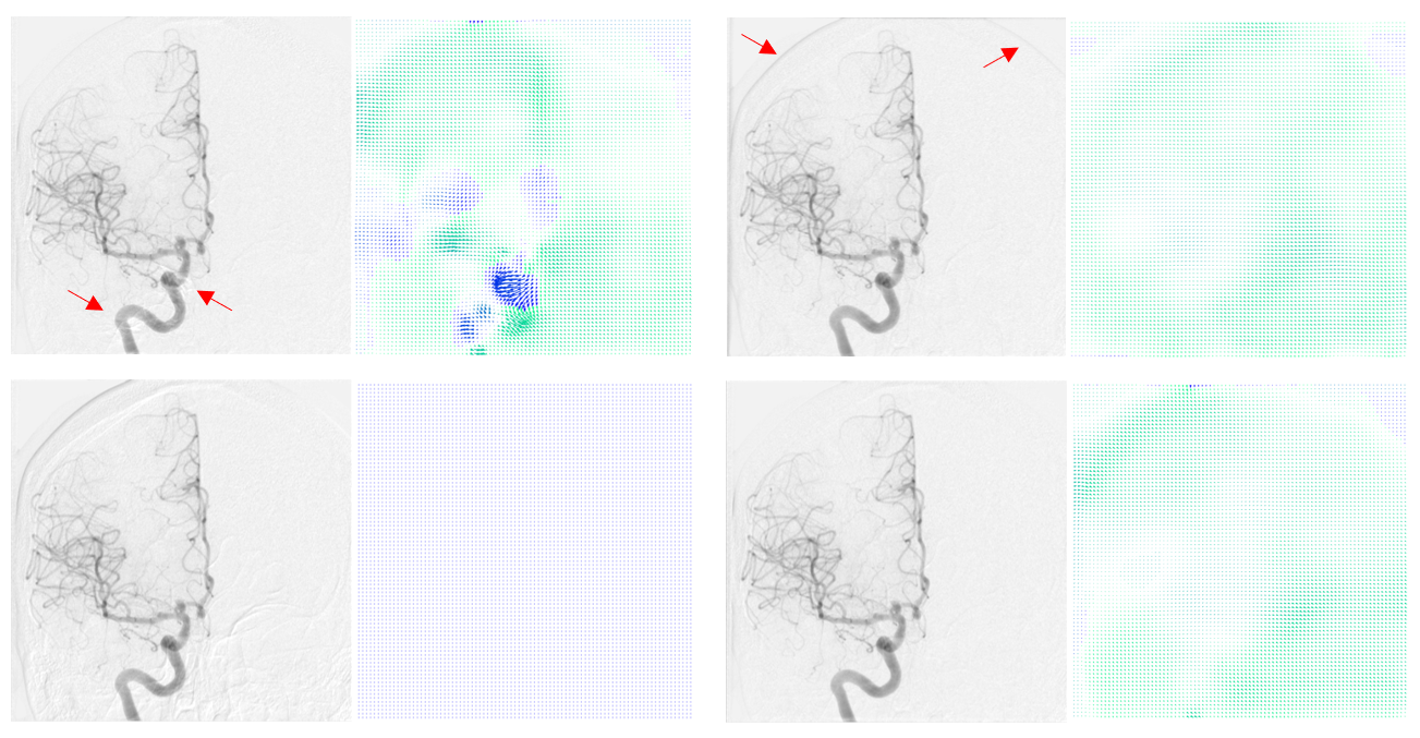 Performance visualization